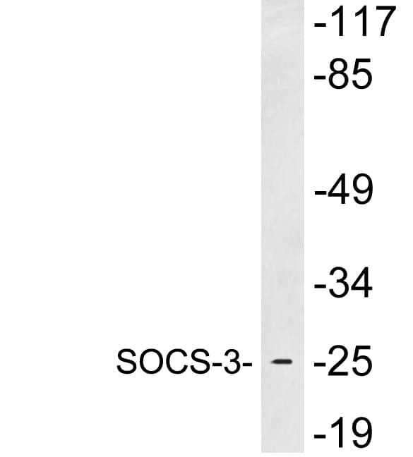SOCS3 Antibody (aa31-80)