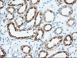 KHK / Ketohexokinase Antibody (clone OTI1D8)