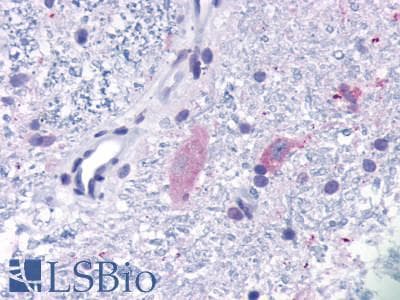 PathPlus™ MRGPRF Antibody (C-Terminus)