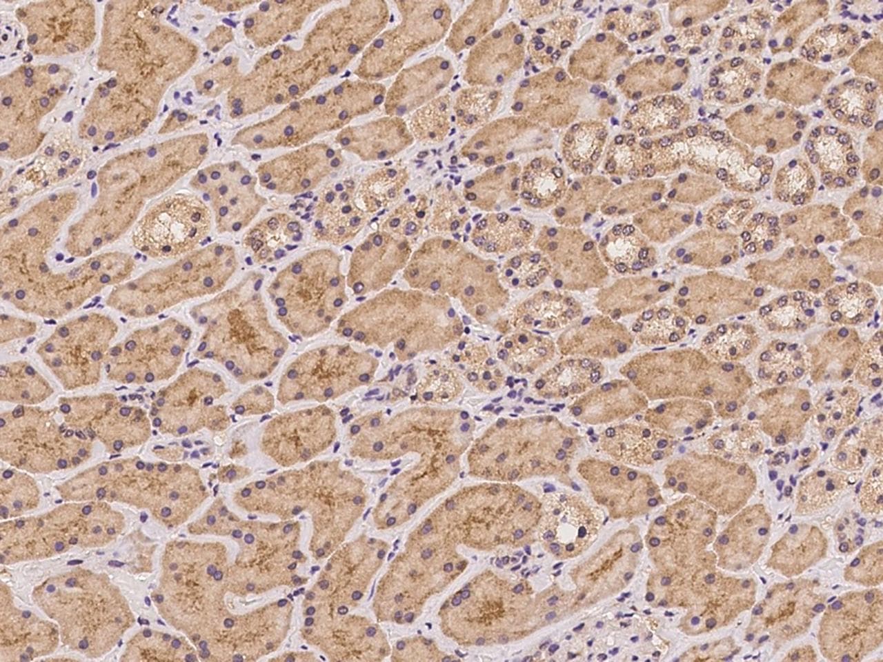 DNAL1 Antibody