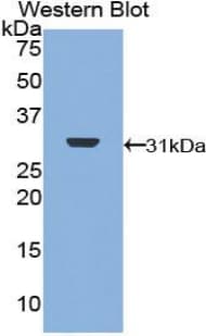 DNA Topoisomerase II Antibody (aa749-987)