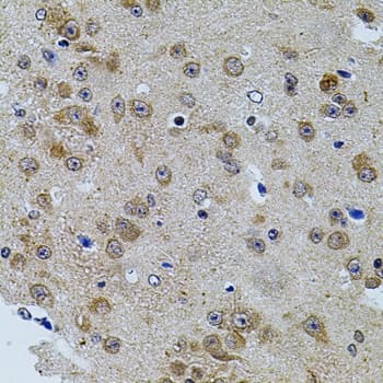 CAST / Calpastatin Antibody