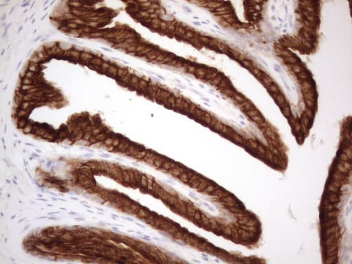 KRT18 / CK18 / Cytokeratin 18 Antibody (aa69-372, clone OTI2H10)