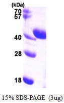 Human ALDOC / Aldolase C Protein (Recombinant His)