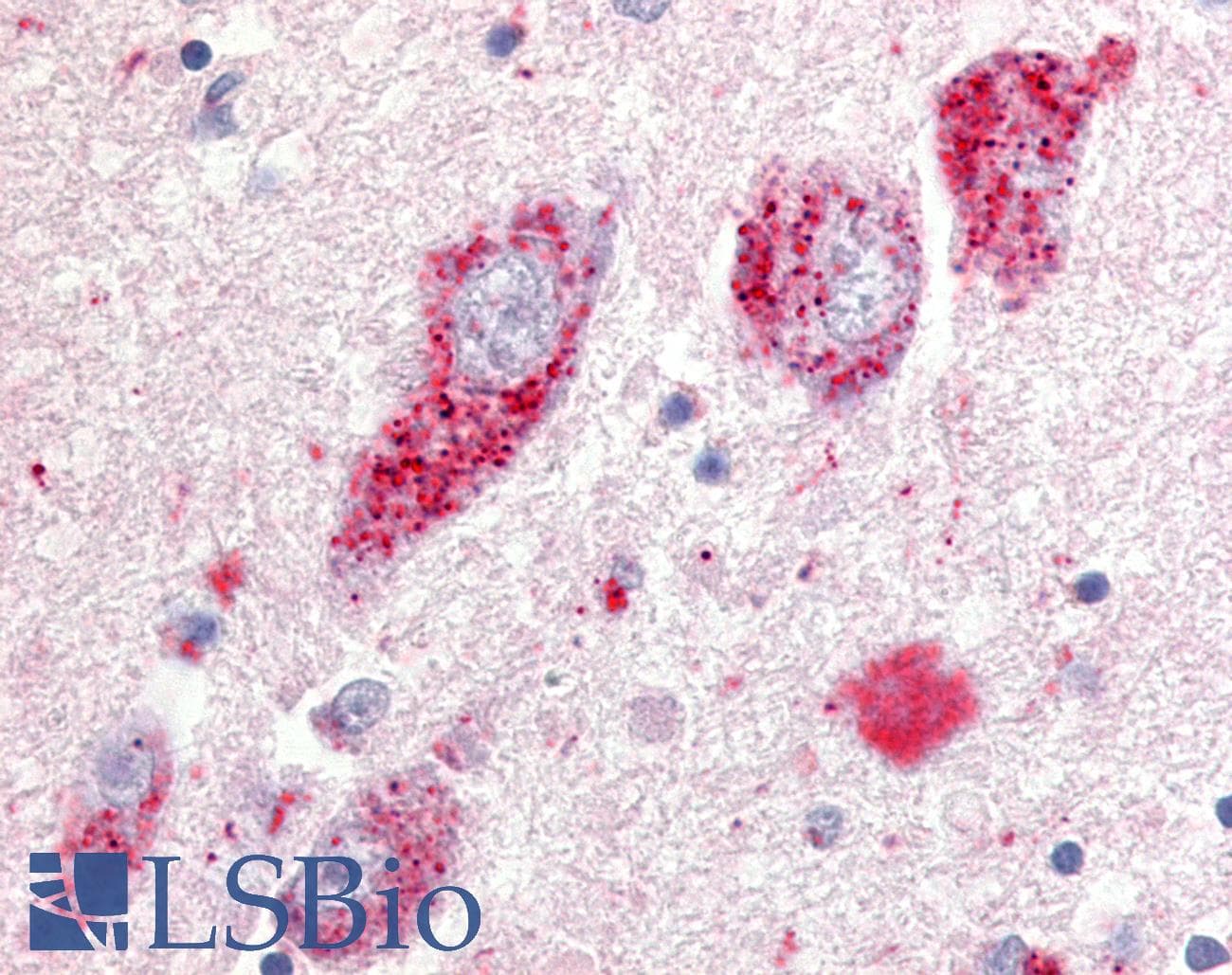 IHC-plus™ GPR20 Antibody (N-Terminus)