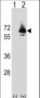PCK2 / PEPCK Antibody (aa24-54)