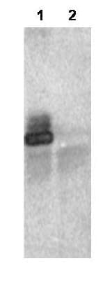 IHC-plus™ Polyclonal Rabbit anti-Human RNF25 Antibody (IHC, WB)