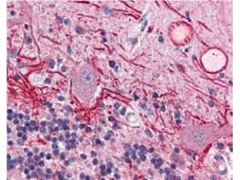 Monoclonal Mouse anti-Human AKT1 Antibody (clone 18F3.H11, phospho-Thr308, IHC, WB)