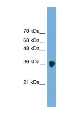 SFRP-3 / FRZB Antibody (aa216-265)