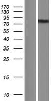 EXOC7 Protein (Over-Expression Lysate Myc-DDK (Flag))