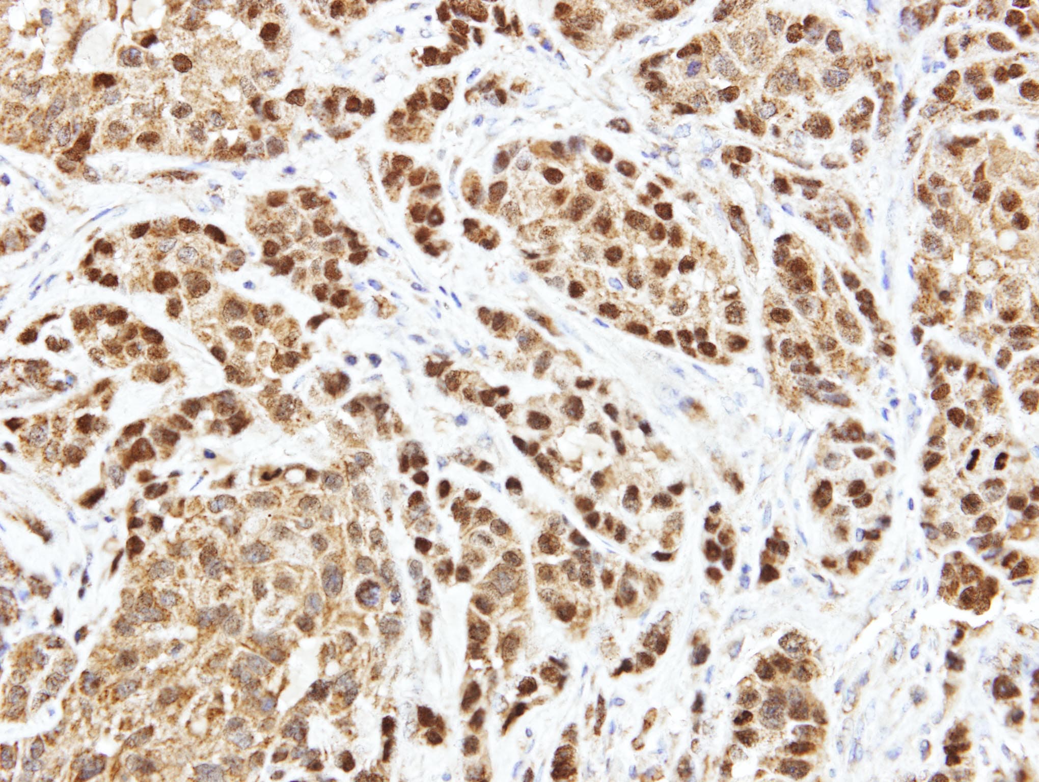 Polyclonal Rabbit anti-Human ARL14 Antibody (aa1-192, IHC, WB)