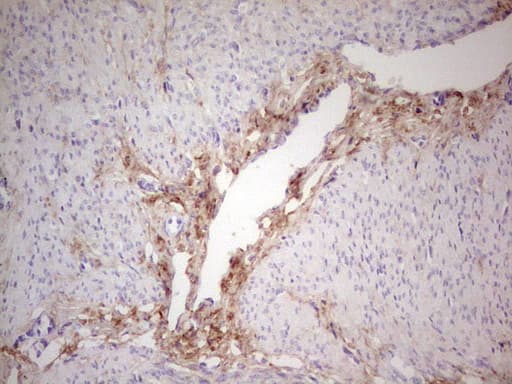 CSNK1G1 / CKI-Gamma 1 Antibody (aa163-422, clone OTI1C5)