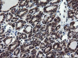 SKIL / SNO / SnoN Antibody (clone OTI3F6)