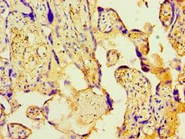 PDHX / Protein X / ProX Antibody (aa1-300)