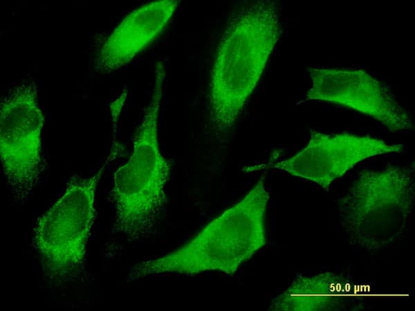 IHC-plus™ CDS1 Antibody (clone 2D10)