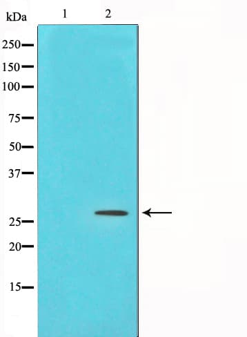 PDGF-BB Antibody