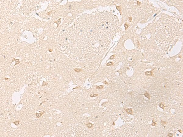 Polyclonal Rabbit anti-Human GPR157 Antibody (IHC)