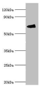 Polyclonal Rabbit anti-Human FANCG Antibody (aa343-622, WB)