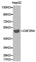 Polyclonal Rabbit anti-Human CSF2RA / CD116 Antibody (IHC, WB)
