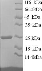 Human HAVCR2 / TIM-3 Protein (Recombinant 6His, N-terminus)