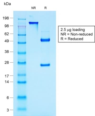 Recombinant Monoclonal Mouse anti-Human EMA / MUC1 Antibody (clone rMUC1/960, Azide-free,Carrier-free, IHC)