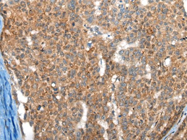FTL / Ferritin Light Chain Antibody