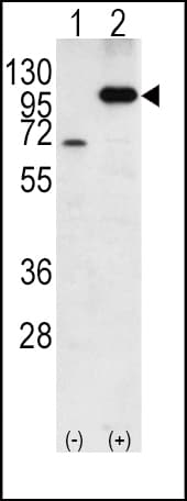 APP / Beta Amyloid Precursor Antibody (aa736-770)