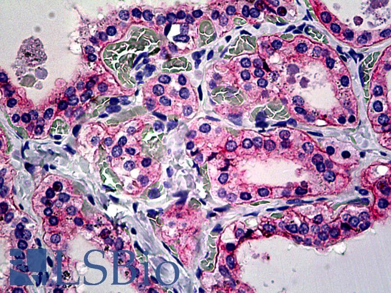 IHC-plus™ Polyclonal Rabbit anti-Human ITGAV/Integrin Alpha V/CD51 Antibody (aa840-889, IHC, WB)