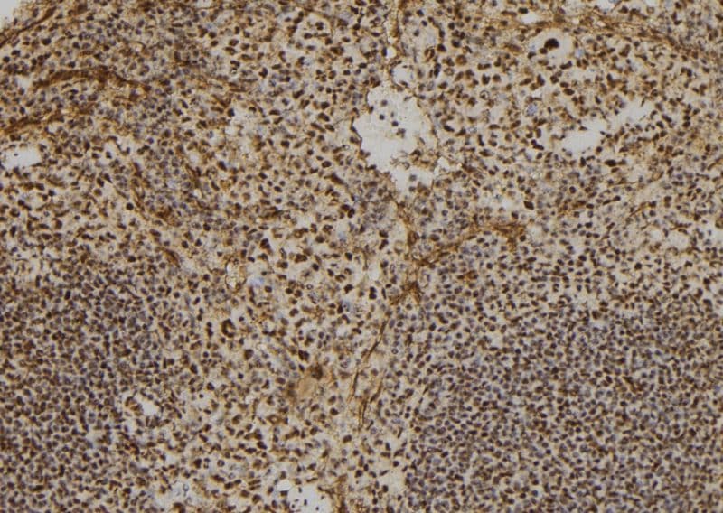 CUL2 / Cullin 2 Antibody