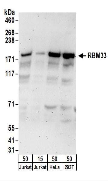 Polyclonal Rabbit anti-Human RBM33 Antibody (aa1-50, WB)