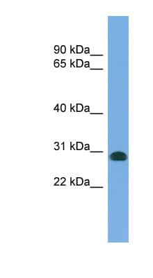 Polyclonal Rabbit anti-Human CENPH / CENP-H Antibody (N-Terminus, WB)