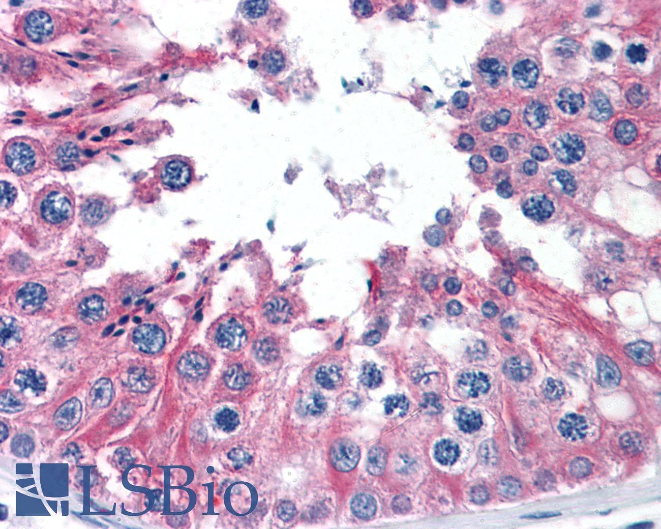 IHC-plus™ TUBA3C / Tubulin Alpha 3C Antibody (clone 3F10-2F2)