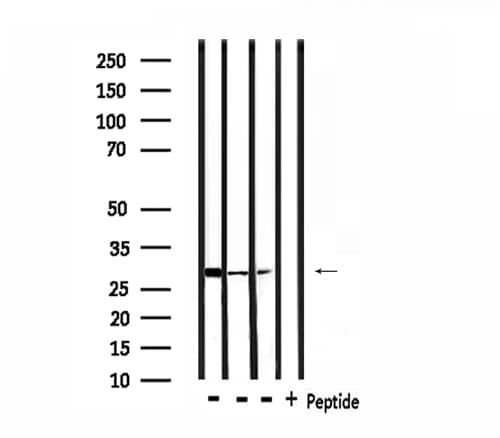 Polyclonal Rabbit anti-Human YWHAE / 14-3-3 Epsilon Antibody (IF, WB)