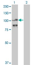 IHC-plus™ Monoclonal Mouse anti-Human ACTN4 Antibody (clone 4D10, IHC, IF, WB)