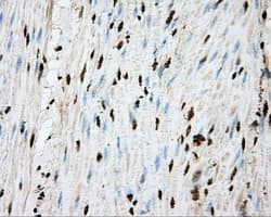 APP / Beta Amyloid Precursor Antibody (clone OTI5F1)