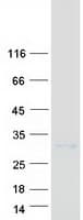 Human Alpha-S1-Casein / CSN1S1 Protein (Recombinant Myc-DDK (Flag))