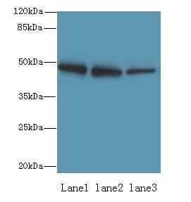 Polyclonal Rabbit anti-Human ZBTB6 Antibody (IHC, WB)