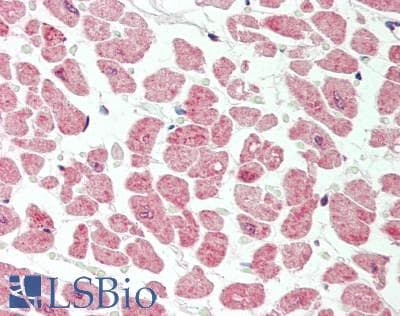 Polyclonal Rabbit anti-Human VPS29 Antibody (aa35-84, IHC, WB)