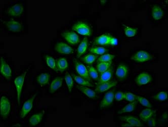 Polyclonal Rabbit anti-Human MMP28 Antibody (IHC, IF, WB)