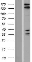 Human CAMSAP3 / KIAA1543 Protein (Over-Expression Lysate Myc-DDK (Flag))