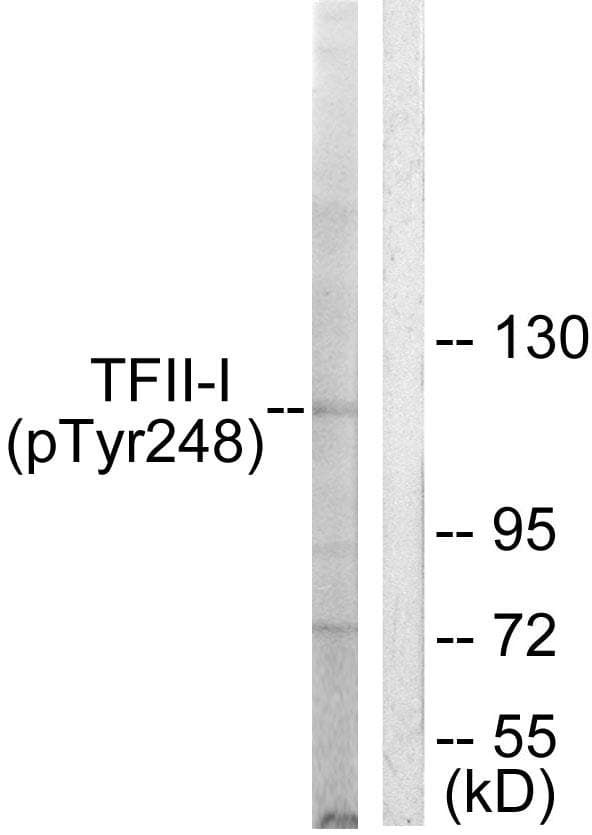 Polyclonal Rabbit anti-Human GTF2I / TFII I Antibody (phospho-Tyr248, WB)