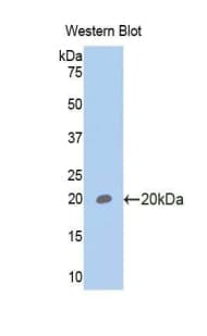 GP6 / GPVI Antibody (aa86-231)