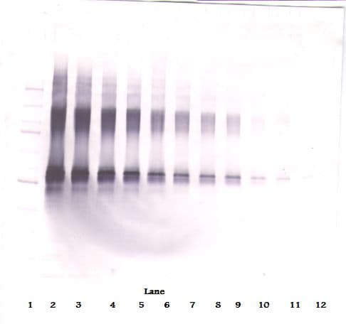IL2 Antibody