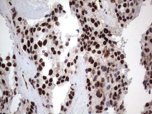 DDX56 Antibody (aa323-547, clone UMAB153)