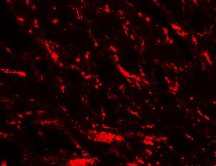 Mitofusin 2 / MFN2 Antibody