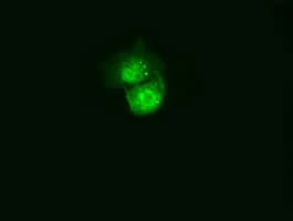 Monoclonal Mouse anti-Human C21orf59 Antibody (clone OTI1A1, IF, WB)