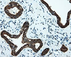 SRR / Serine Racemase Antibody (clone OTI2E3)