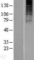 TACR3 / NK3R Protein (Over-Expression Lysate Myc-DDK (Flag))