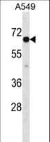 Polyclonal Rabbit anti-Human CLPTM1L / CLPTM1-Like Antibody (aa370-399, WB)
