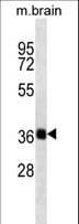SYP / Synaptophysin Antibody (aa225-253)